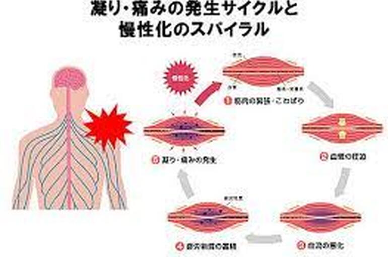 肩凝り