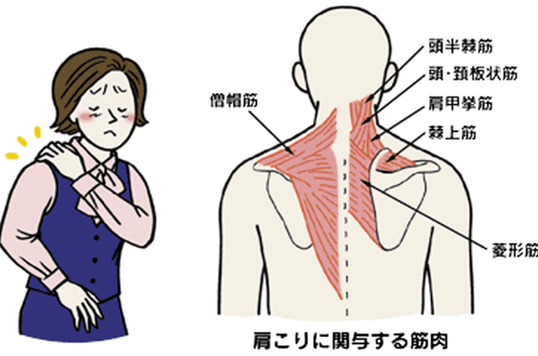 肩凝り筋肉
